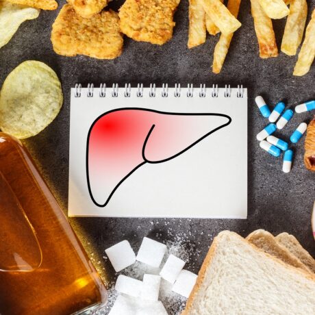 Chipsuri, dulciuri, prăjeli și alcool - alimente contraindicate în dieta pentru ficat gras și mărit