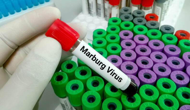 Ce este virusul Marburg și cât e de periculos. Ce spune doctorul Adrian Marinescu despre o posibilă infectare în România